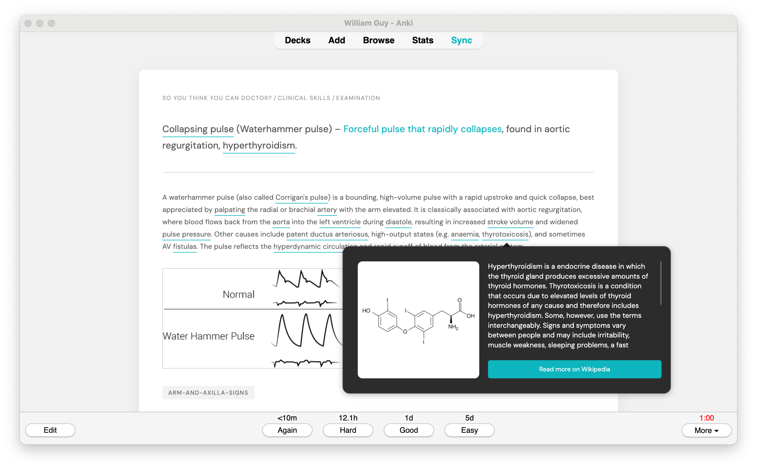 Ankipedia Demo Image 2