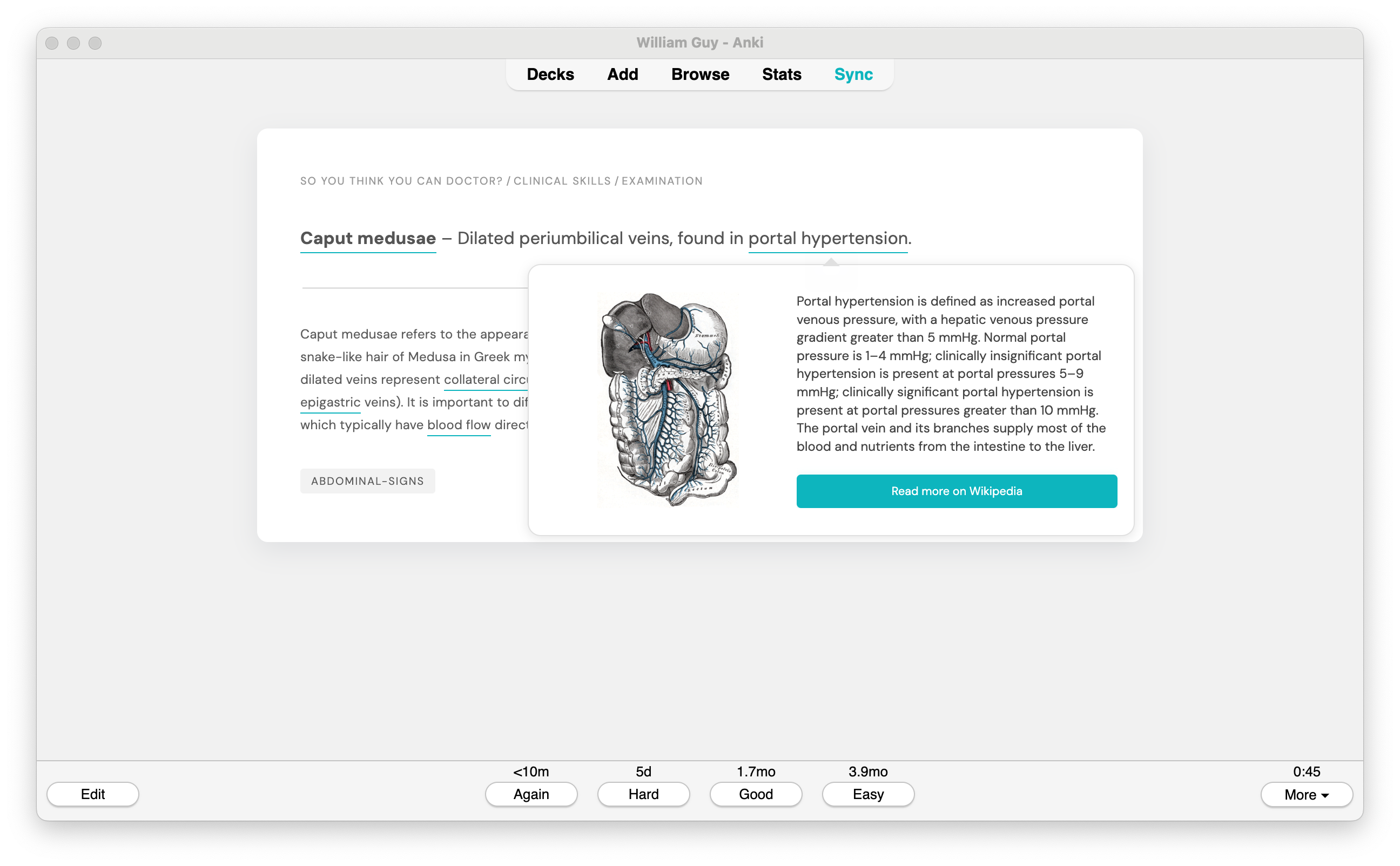 Ankipedia Demo Image 4