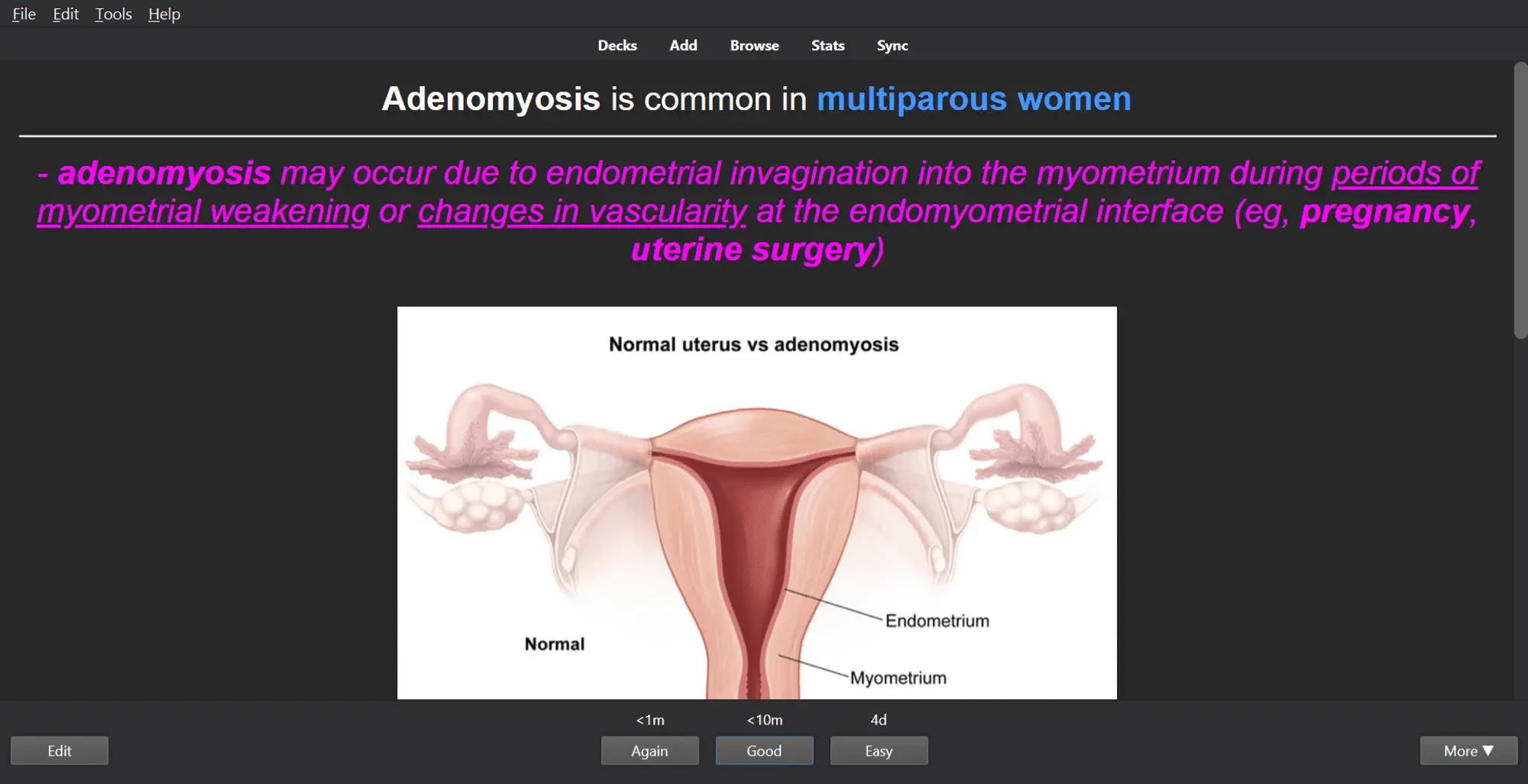 Zonkoo UWorld Decks — The Ultimate UWorld & Anki Combination